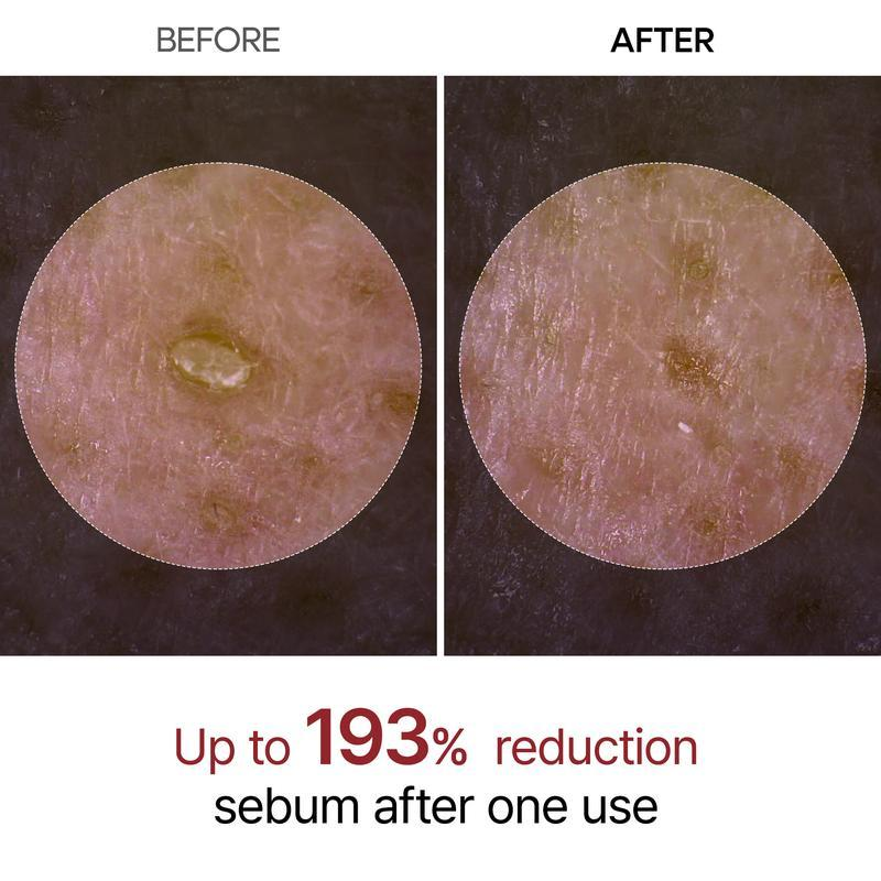 ✨✨Last Day 50%OFF:Peel Shot Glow White Rice Peeling Ampoule.。。